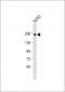 ERBB2 Antibody(C-term Y1248)